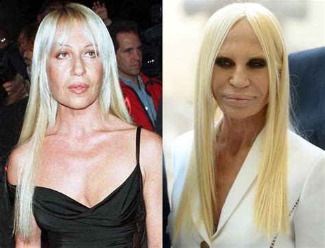 versace plastic surgeries|donatella versace without plastic surgery.